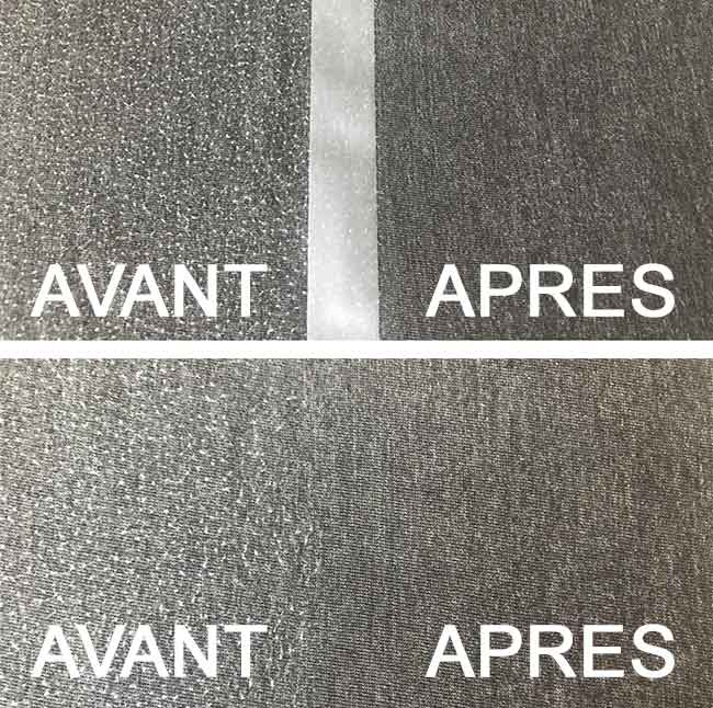 avant apres rasoir anti bouloches philips